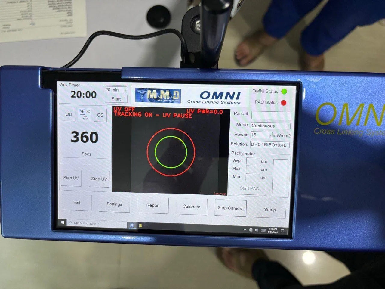 OMNI cross-linking console showing treatment mode, power and timing during a procedure